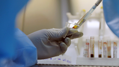 HIV最新型，时代背景下的探索与挑战